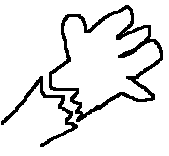 Carpal tunnel